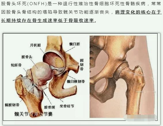 股骨头解剖结构_股骨头解剖图